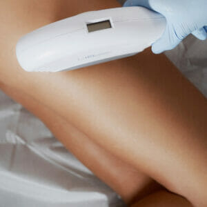 Clinica Noelia Gon - Aparatologia - Fotorejuvenecimiento Laser