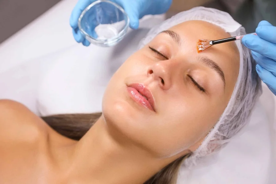 peeling-quimico-facial